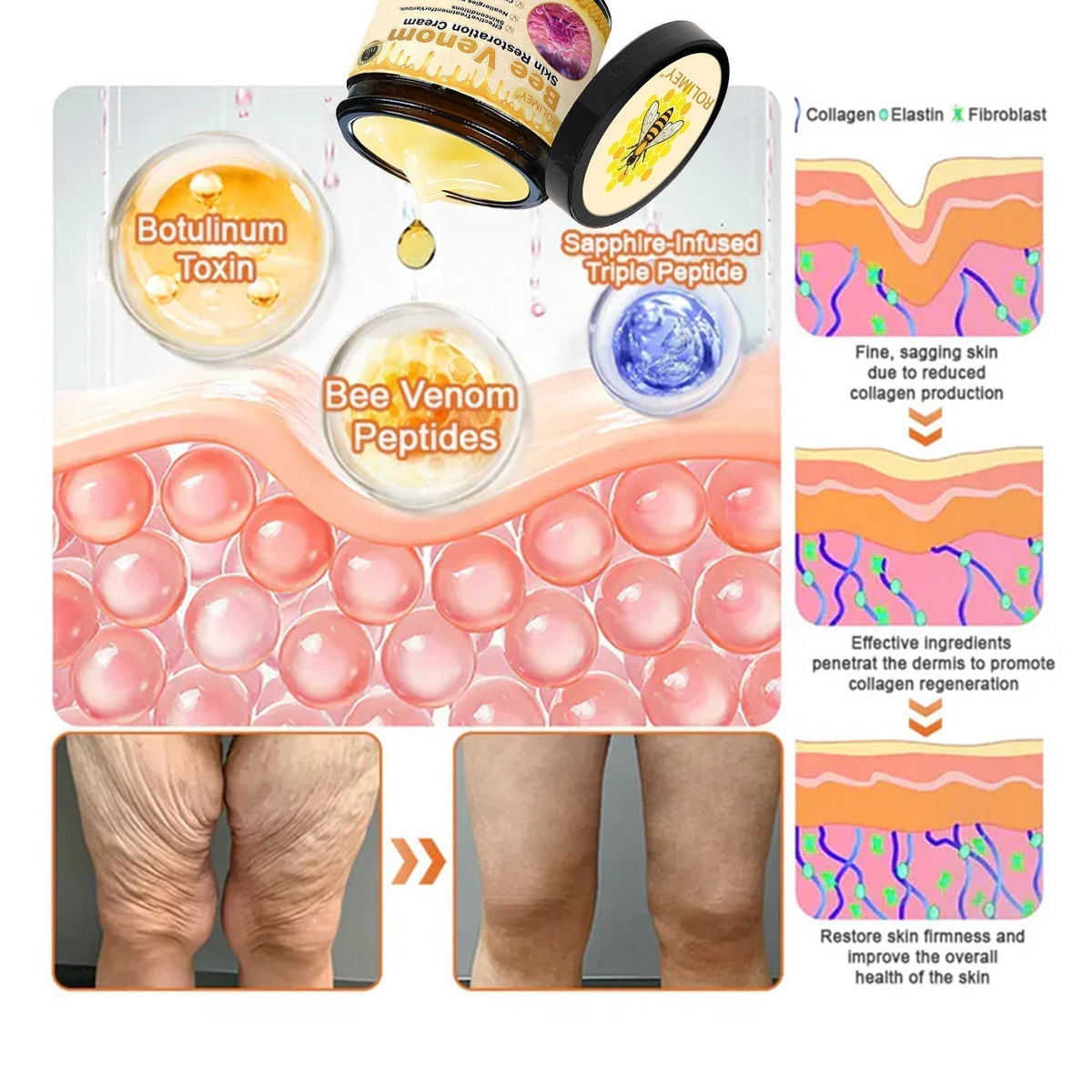 🔥Official Brand Shop丨Rolimey® Bee venom Pro Comprehensive Cream—Tightening for Skin Types